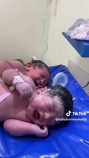 Adorable Twin Girls: A Heartwarming First Cry Moment
