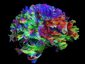Whole brain fiber tractography