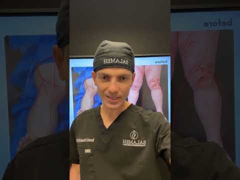 Salameh Plastic Surgery Center