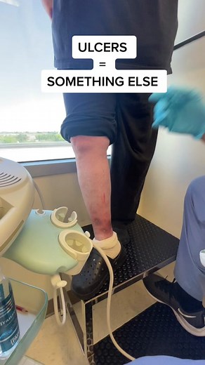 Understanding and Treating Venous Ulcers at the Medial Ankle