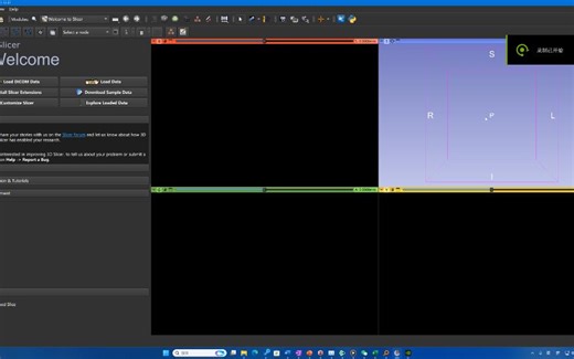 【3D Slicer】开发 | 从0开始定制自己的3D Slicer——创建插件