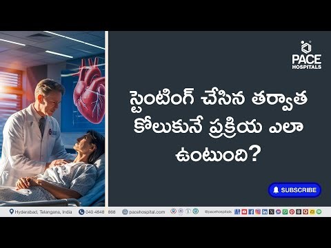స్టెంటింగ్ చేసిన తర్వాత కోలుకునే ప్రక్రియ ఎలా ఉంటుంది? | Recovery After Stenting #stent