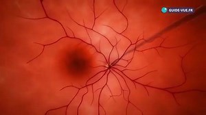 Les organes de l'œil en 3D | Le saviez-vous? Version Médecine