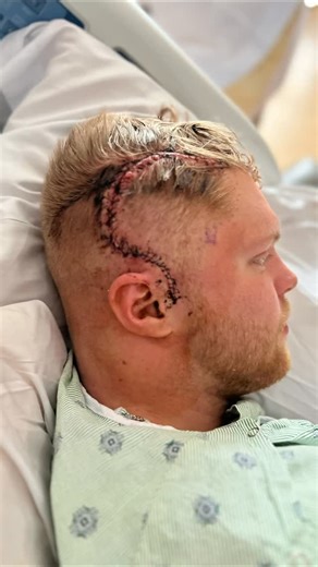 Tristan Jass on Instagram: "Day 1 of Brain Surgery on my 26th birthday… ❤️🧠🙏🤞"