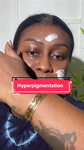Je sais que je ne suis pas la seule dans le cas, raison pour laquelle j’en parle tout le temps! Hyperpigmentation huuuuummmm c’est assassin peur t’envoyer directement à la dépression huuuummm heureusement que @TaSkinTherapeute_Pro est là pour te sauver. @Akuélé@capo @shine _creations @ENTER KO COME OUT OK @RielleJewelerysets pour ma bague et mon bracelet.