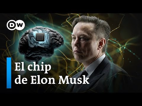 Telepathy: el implante cerebral de Musk
