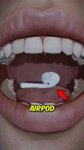 Why Swallowing an AirPod Could Land You in the Hospital