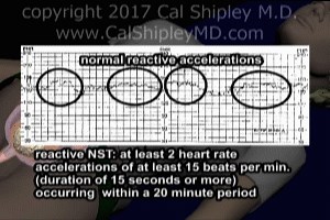 Fetal Nonstress Test Video - Trial Image Inc.