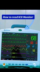 How to read ICU Monitor. Nursing Officer 💥 #foryouシ #trend #medical #nursing #MBBS #paramedics #health #viralposts #jumanjichallenge #jumanjichallenge #kannywood #kannywoodactor #kannywoodstyle #kannywoodNews #Kannywoodactress #kannywoodmedia #kannywoodtunabaya #kannywoodexclusive #kannywoodcelebritiesKBeautiful Actres # jamilanagudu with #Yar_arewa and also known as #Hajiya_aisha in #Sanda_series movie📽📺👈#imran #kannywoodstyle #kannywoodmedia #BOOMchallengeBOOMchallenge #BestPhotographyChal