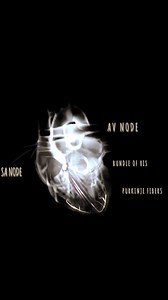 93 reactions · 29 shares | ✨Summary of the heart’s conduction system and Cardiac Electrophysiology⚡✨ #Cardiology #HeartHealth #Electrophysiology #Arrhythmia #HeartRhythm #CardiacConduction #MedicalScience #HealthcareInnovation #InspireScience #MedicalResearch #HeartCare #CardiologyEducation #CardiologyAwareness #CardiologyFellows | Abdallah Othman | Facebook