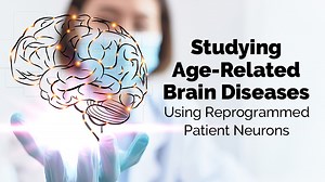 VIDEO: Capturing Late-Onset Neurodegeneration in Patient-Derived Neurons via Direct Reprogramming - Breaking News in Stem Cells