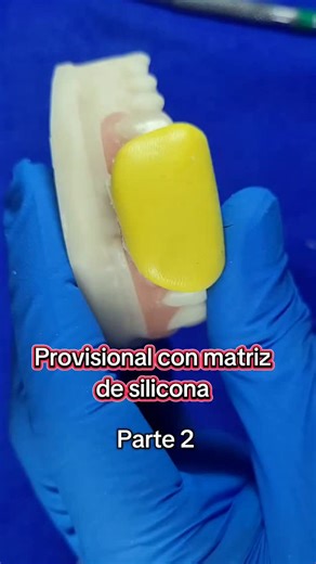 Walbin Gale Ropain on Instagram: "Provisional con matriz de silicona - PARTE 2"
