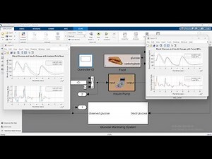 Artificial Pancreas in MATLAB | Full Tutorial 2025