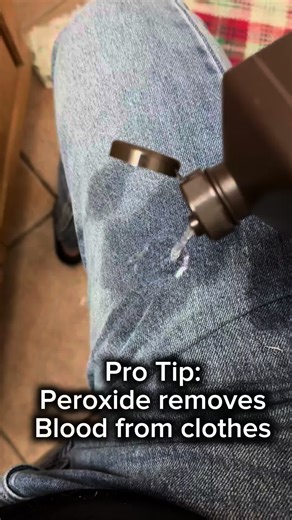 Removing Blood Stains with Hydrogen Peroxide (The Right Way) Blood stains don’t need special detergents or gimmicks. This is one of the simplest, most effective methods—and it’s been around forever. Hydrogen peroxide works because it breaks down the proteins in blood. When it bubbles, that’s the stain lifting out of the fabric. What you need 3% hydrogen peroxide Clean cloth or paper towel Cold water Optional: baking soda (for stubborn stains) Step-by-step 1️⃣ Act as soon as possible Fresh stains