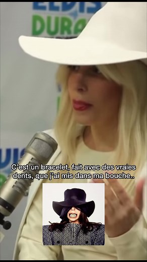 Unique Art Piece: Real Teeth Bracelet Explained