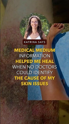 Medical Medium Information Helped Me Heal When No Doctors Could Identify the Cause Of My Skin Issues