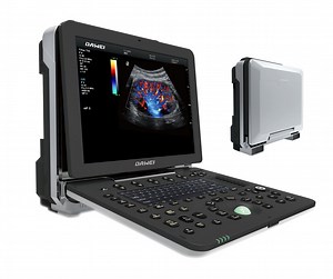 [Hot Item] 15inch HD Screen Portable 4D Echo Cardiovascular Digital Doppler Ultrasound for Cardiology