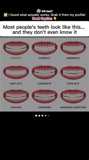 😁✨ A Healthy Smile = A Confident You! 💪🦷 #TeethGoals 🦷😁💪💫