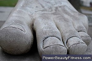 Πόνος Στο Κουτουπιέ Κατά Το Τέντωμα 💪💪 Όλα Για Το Γυμναστήριο Και Τον Υγιεινό Τρόπο Ζωής - 2025