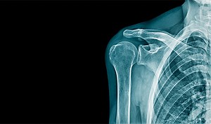 Radiology (Imaging) | Central Ohio Primary Care