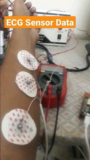 ESG Monitoring using AD8232 module with node mcu #shorts