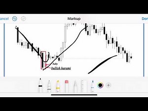 Forex Candlestick Analysis Explained 📊 Full start-to-finish breakdown + a clean trading strategy
