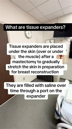 Tissue expanders are a medical device used in the breast reconstruction process to stretch the breast skin. They’re filled with saline several times in order to gradually stretch the skin. #breastcancer #triplenegativebreastcancer #tnbc #breastcancerunder40 #breastreconstruction | Devean R. Owens-Toler
