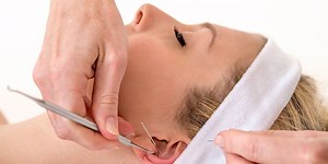 Should You Try Ear Acupuncture? Here's What It's All About