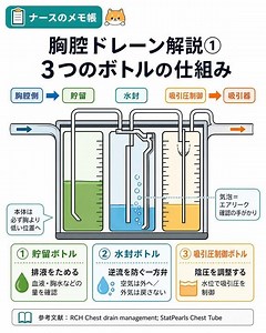 胸腔ドレーン3つのボトルの仕組み