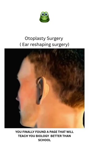 BIOLOGY | MEDICAL | HEALTH on Instagram: "Otoplasty is a cosmetic and reconstructive surgery to improve the position, shape, or size of the ears, making them more proportional to the face. The procedure can correct prominent, misshapen, or asymmetrical ears caused by congenital conditions, injury, or trauma. The surgery involves altering the ear cartilage and skin through incisions, often made behind the ear, and then suturing it into a new position. Dm for credit or removal 👏🏻🙏🏻 For educati