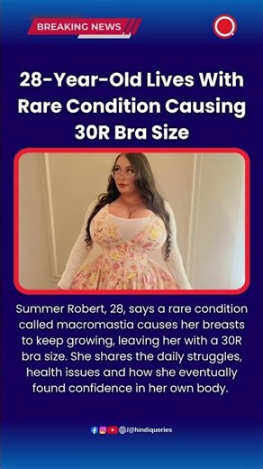 28-Year Old Lives With Rare Condition Causing 30R Bra Size #Macromastia #RareCondition