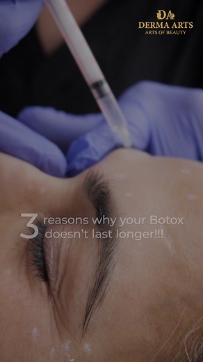 3 Factors That Can Impact the Longevity of Botox: ✔️Metabolism Speed: Your body's metabolism impacts the rate at which Botox is broken down. Individuals with faster metabolisms may experience shorter-lasting effects. ✔️Product Quality: Botox's Potency Relies on Temperature and Storage Conditions. Proper refrigeration is essential to maintain its effectiveness. Additionally, the quality and source of the Botox product play a significant role in its longevity. ✔️Dosage: Many patients hold the misc