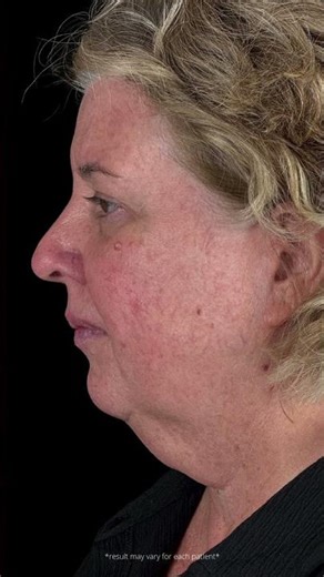 💫 𝐈𝐍𝐒𝐓𝐀𝐍𝐓 𝐑𝐄𝐖𝐈𝐍𝐃!💫