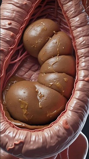 How Constipation Stool Comes Out | Realistic AI Art | Gut Health | Anatomy AI Arts USA | 27