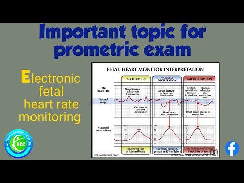 Early deceleration ,Late deceleration, Variable deceleration in ELECTRONIC FETAL HEART MONITORING