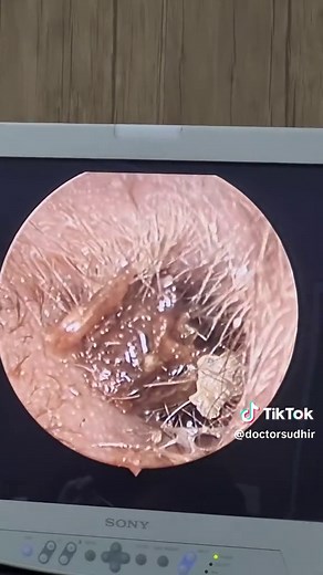 Doctor Tips for Better Ear Care
