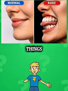 Can You Answer All the Quiz Questions?