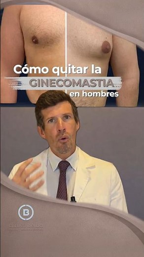How to remove gynecomastia in men: surgical technique and natural result