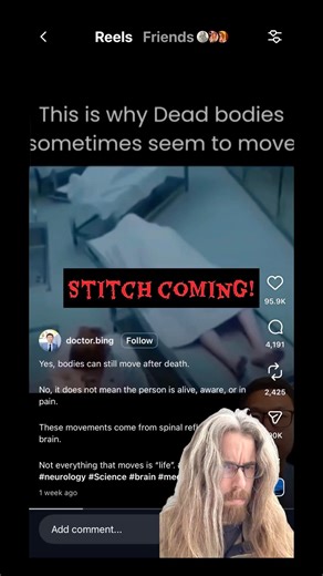 Fake. Trust the forensic pathologist on this. @doctorbing #science #learn #forensics