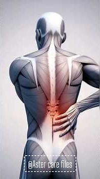 How Spinal Injection Works for BackPain#epidural#sciatica#sciatic#discpain#backproblem