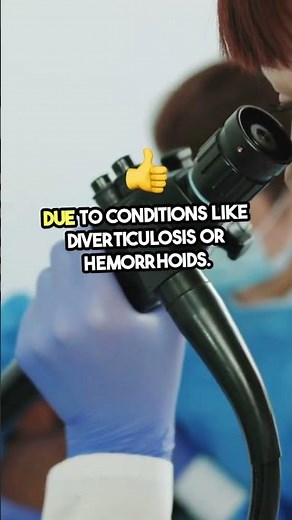 Gastrointestinal (GI) Bleeding: Causes, Symptoms, and Treatment