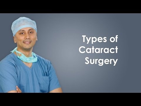 Types of Cataract Surgery