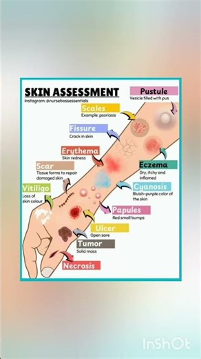 Skin Assessment Explained | Clinical Skills Every medical student Must Know!"