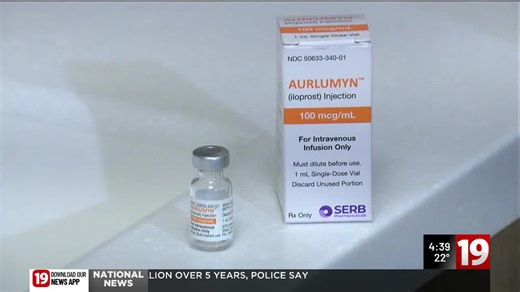 New frostbite drug dramatically reduces frostbite amputations at Akron Children’s Hospital