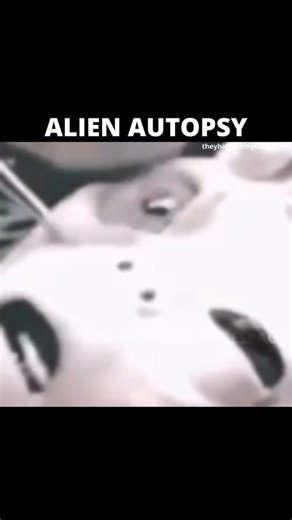 UAPs Today 🛸 on Instagram: "It’s not fiction—it’s evidence. A declassified video reveals what appears to be an alien autopsy, a body recovered from a crashed UFO. The footage is so advanced for its time that even today, experts admit it would be nearly impossible to fake. 🕯 Not illusion. Revelation. - The surgical procedures, the precision, the atmosphere—too detailed to be dismissed as a hoax. - The body shows features beyond human biology, challenging everything we thought we knew. - What wa