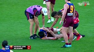 Concussion in sport – are football clubs doing enough?