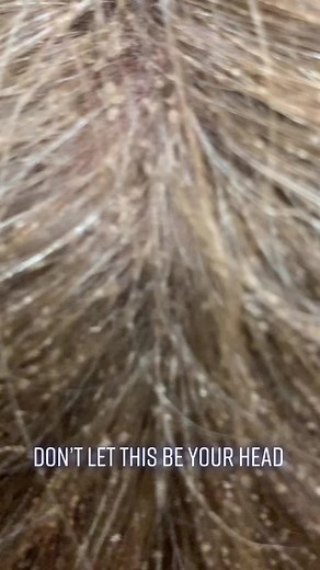 The Lice Goddess on TikTok