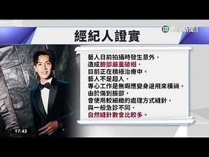 柯震東遭無人機撞臉 經紀人證實"嚴重破相"｜華視新聞 20230109