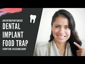 The Struggle of Dealing with a Food Trap in My Mouth