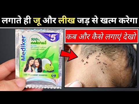 Mediker Shampoo How To Use | how to use mediker shampoo for lice | mediker shampoo